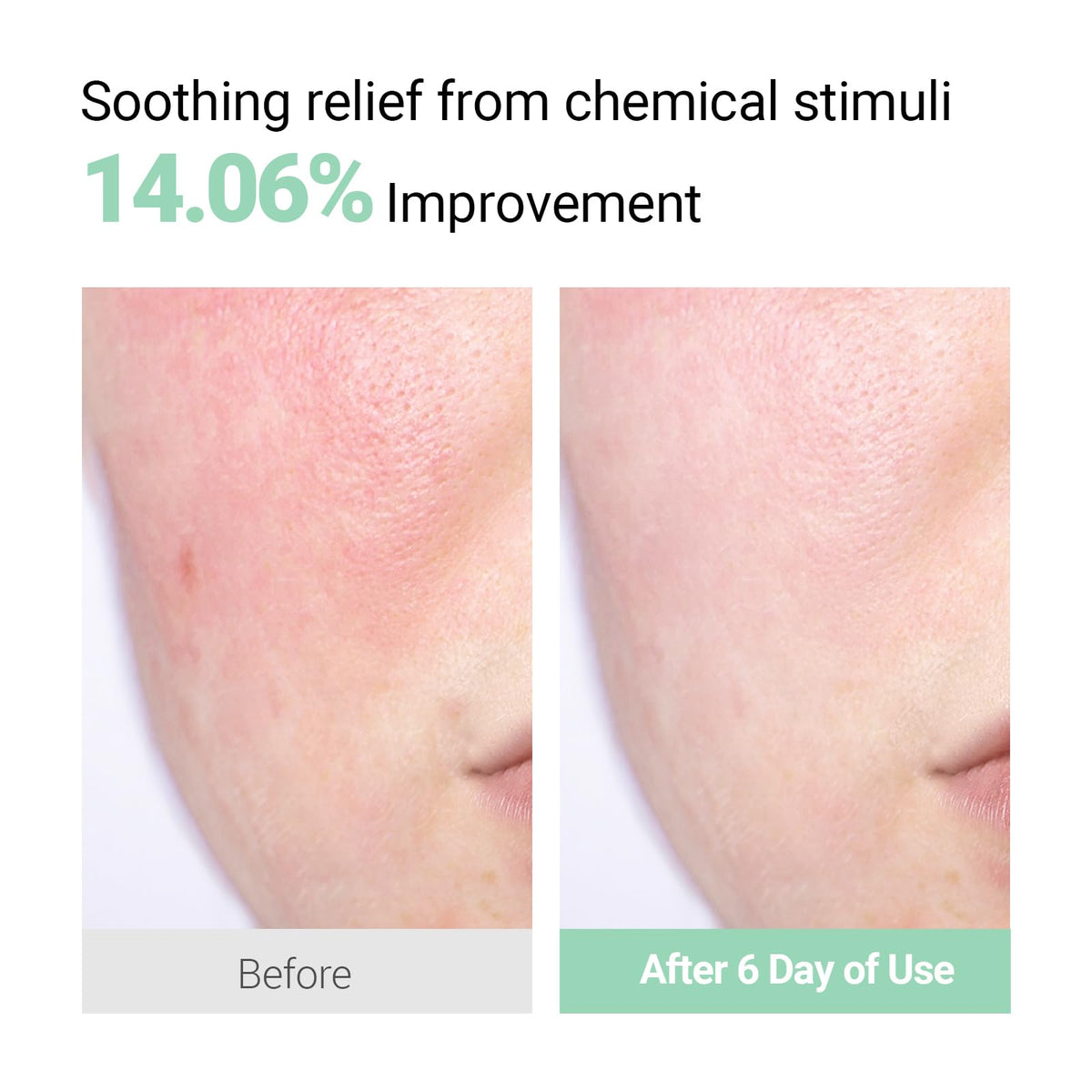 NEAF NEAF cream on skin demonstrating immediate moisture boost