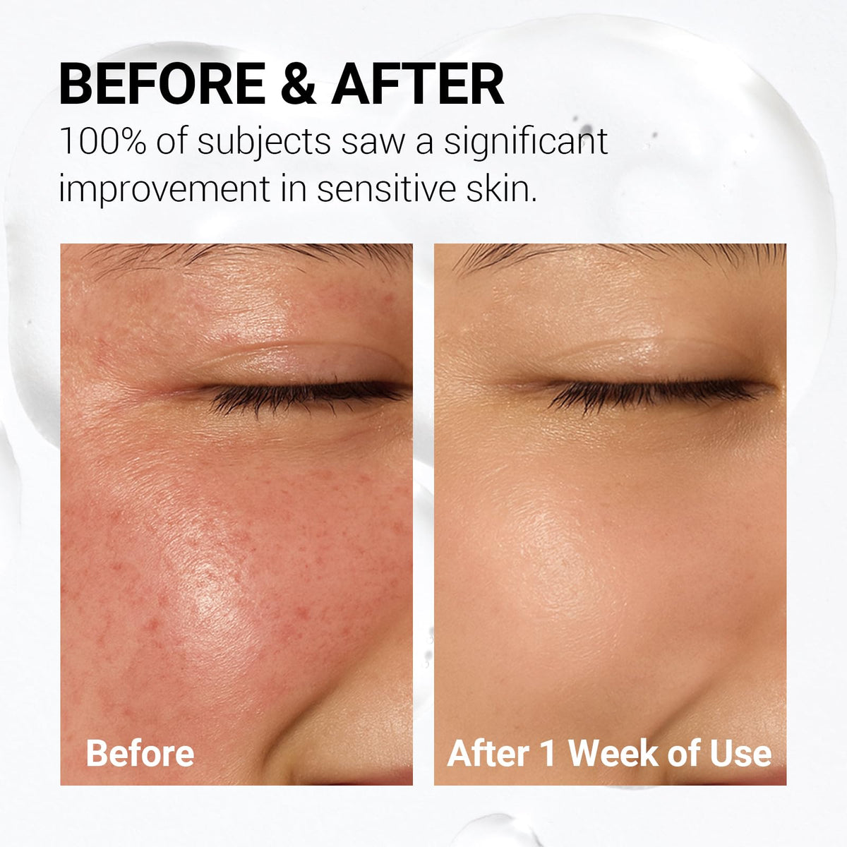NEAF NEAF pad applied to cheek during routine, shows fast soothing and calming benefit
