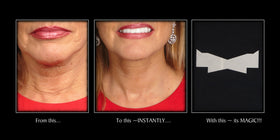Person wearing NeckTITE Magic at an evening event showing smooth youthful neck