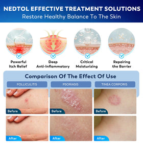 Nedtol applied to scalp demonstrating targeted follicle care and calm