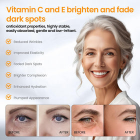 NEIOM serum beside sunscreen and moisturizer, illustrates layering in routine