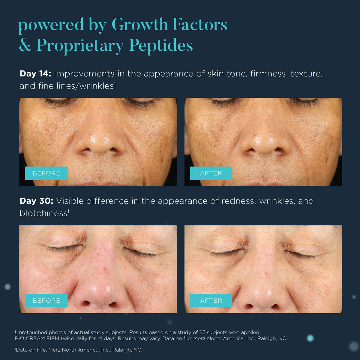 NEOCUTIS applied to neck and décolleté illustrating smoothing benefit