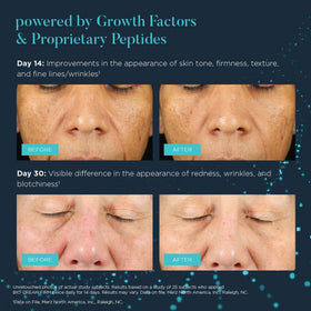 NEOCUTIS on healing skin after cosmetic treatment showing soothing support