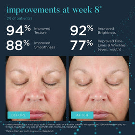 NEOCUTIS applying serum to face illustrating layering before moisturizer