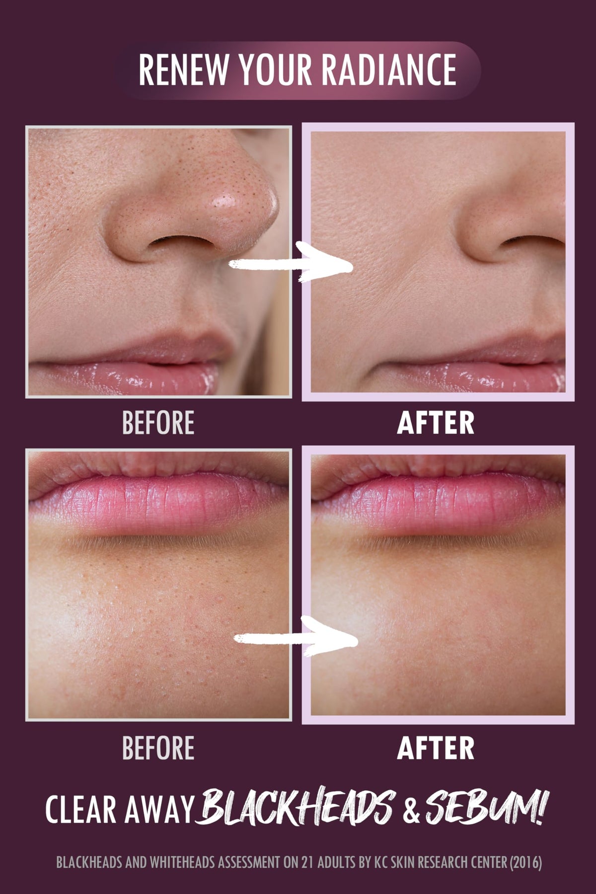 NEOGEN ingredient label close-up highlighting product benefits and clarity