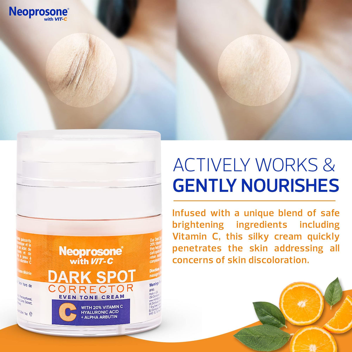 Neoprosone applied to hand demonstrating targeted coverage