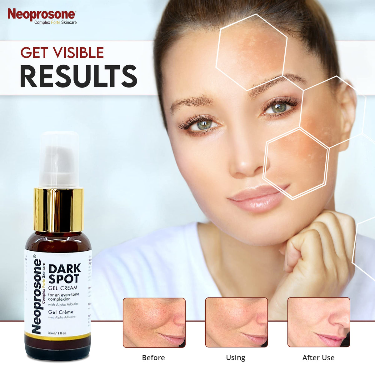 Neoprosone cream on fingertip ready to apply, illustrates easy targeted application