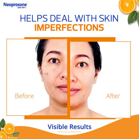 Neoprosone ingredient label highlighting vitamin C blend
