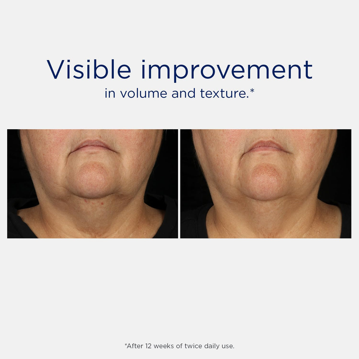 NEOSTRATA application on cheek demonstrating easy layering and fast absorption