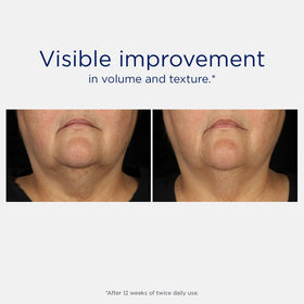 NEOSTRATA application on cheek demonstrating easy layering and fast absorption
