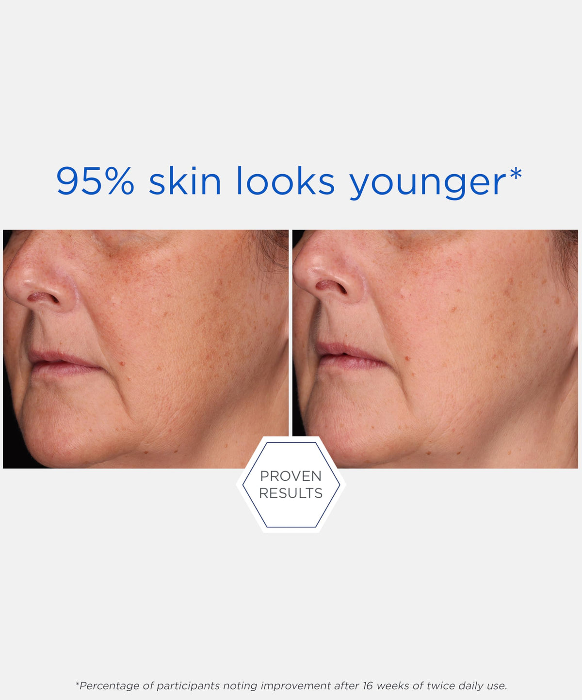 NEOSTRATA cream held in hand to show 1.7 oz scale and travel-friendly size