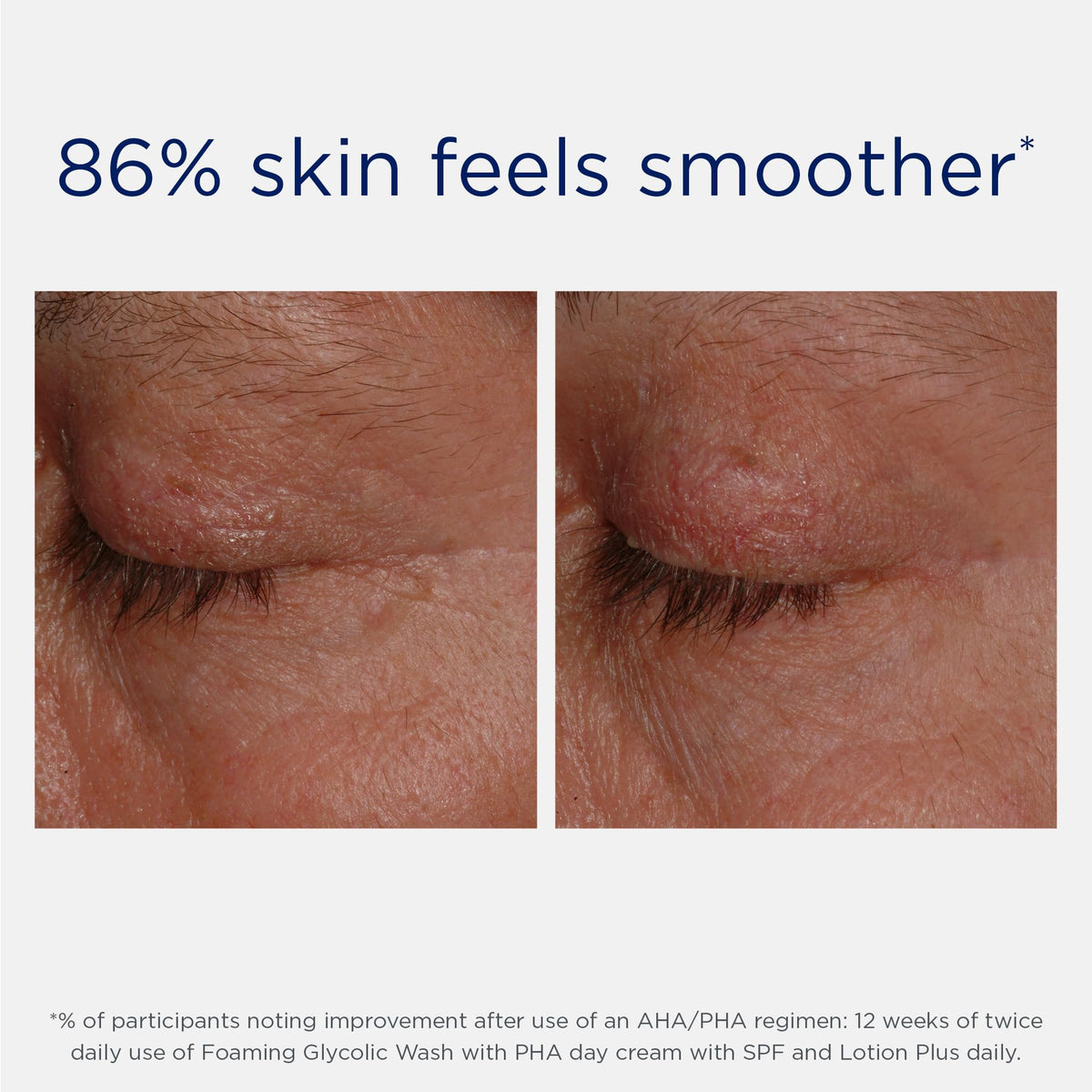 NEOSTRATA illustrative before and after skin texture improvement visual