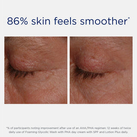 NEOSTRATA illustrative before and after skin texture improvement visual