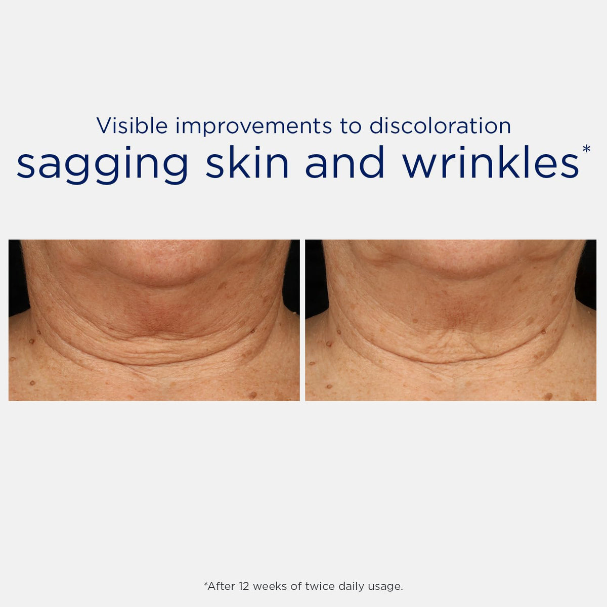 NEOSTRATA ingredient visual of MicroDiPeptide229 emphasizing targeted delivery