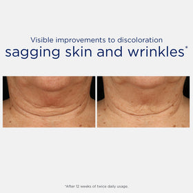 NEOSTRATA ingredient visual of MicroDiPeptide229 emphasizing targeted delivery