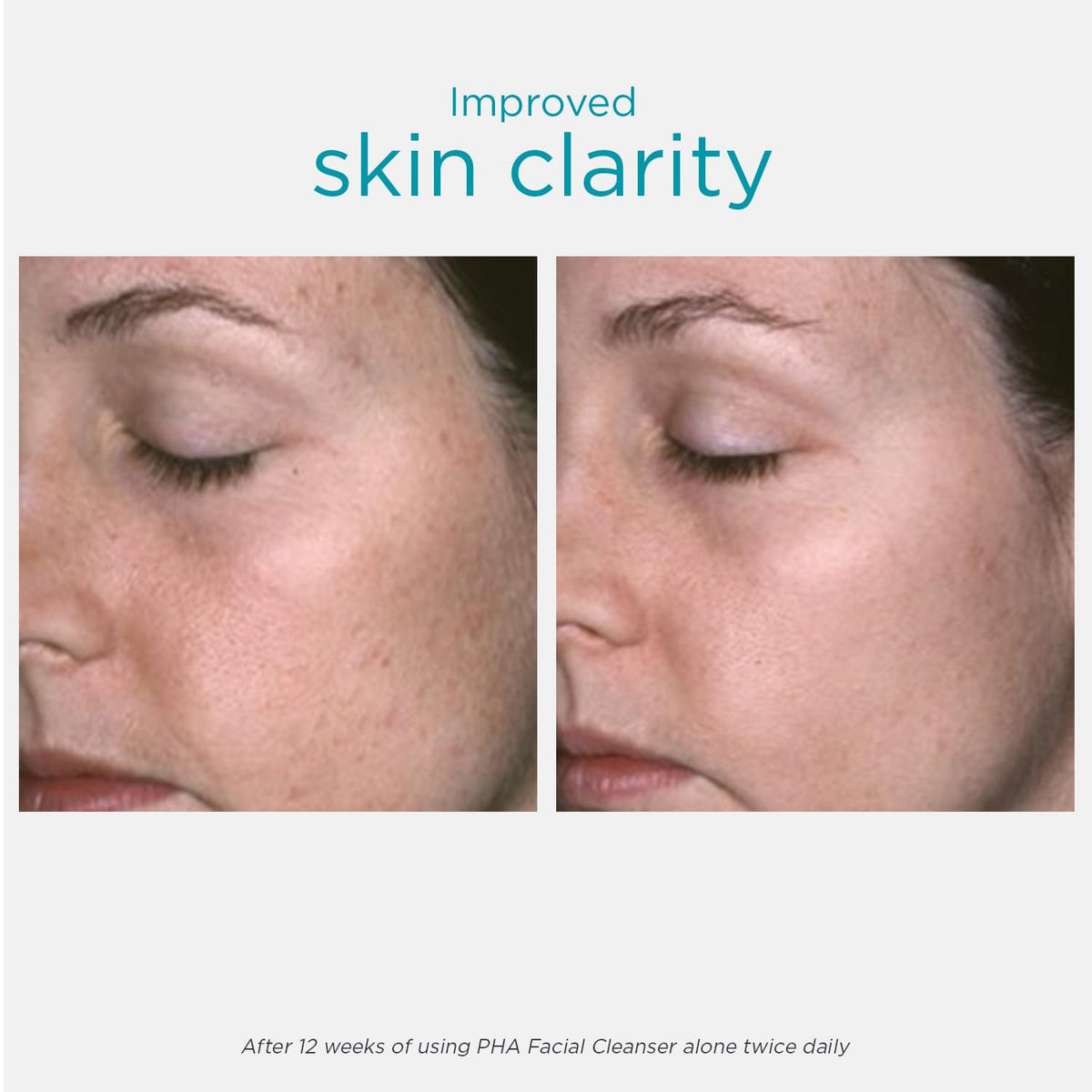 NEOSTRATA gel texture close-up showing non-foaming, hydrating feel