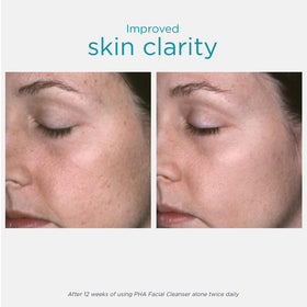 NEOSTRATA gel texture close-up showing non-foaming, hydrating feel