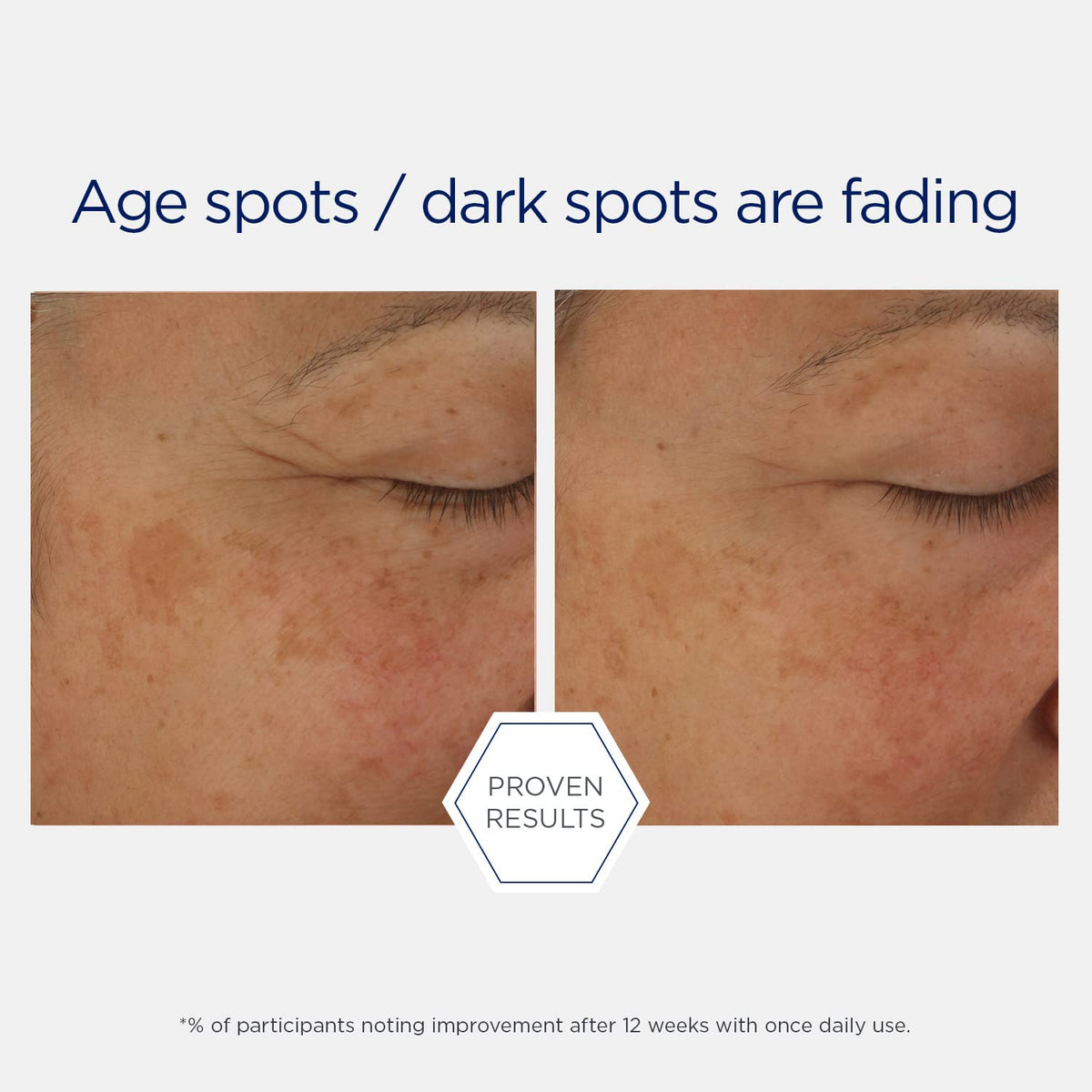 NEOSTRATA in a night routine setting showing evening use and skincare layering benefit