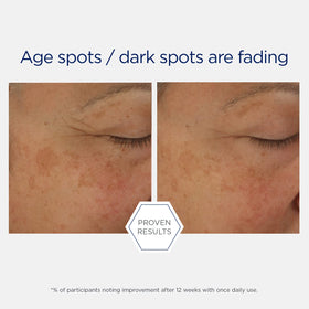 NEOSTRATA in a night routine setting showing evening use and skincare layering benefit