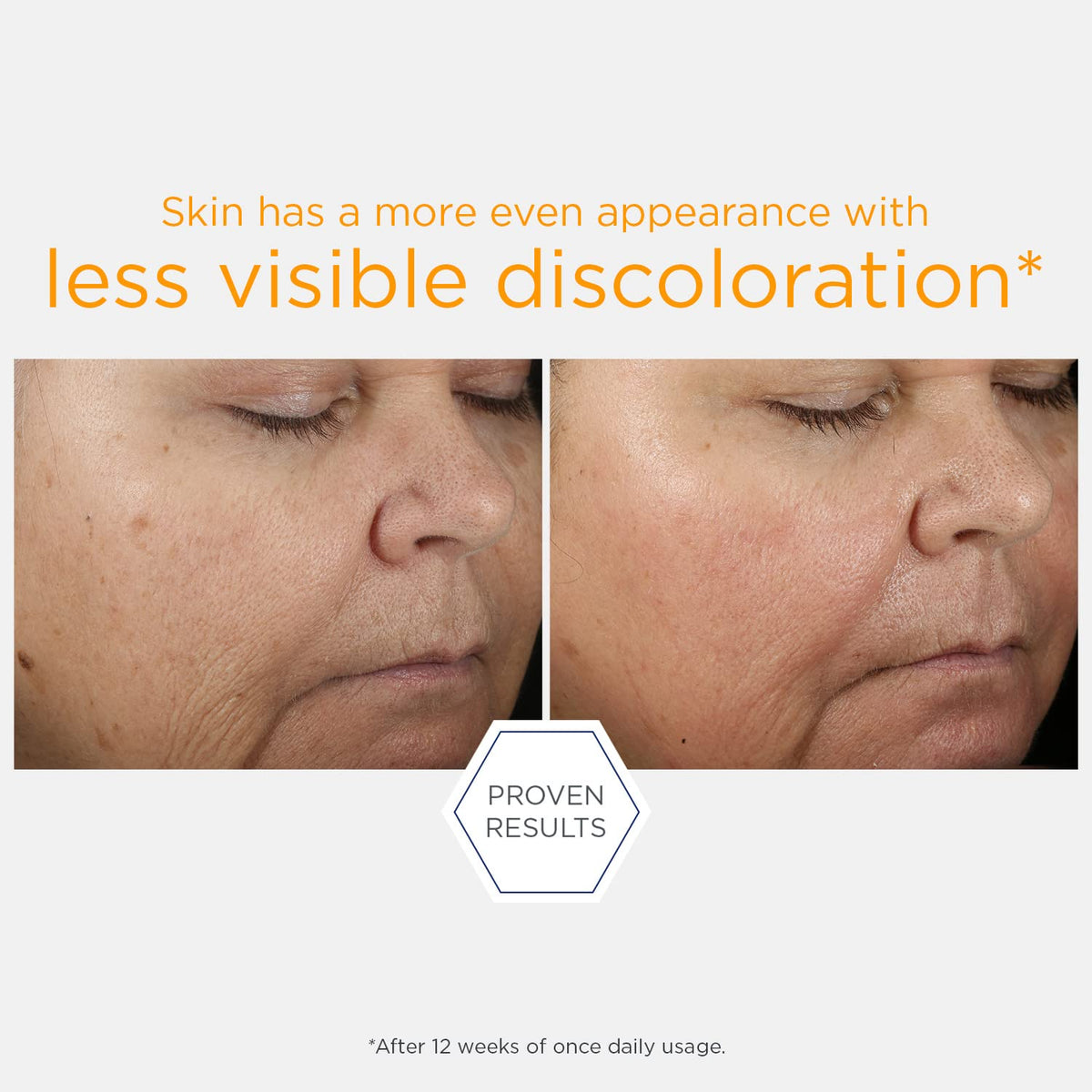 NEOSTRATA applying serum to face to show easy layering under moisturizer