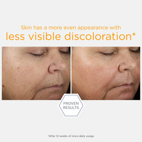 NEOSTRATA applying serum to face to show easy layering under moisturizer