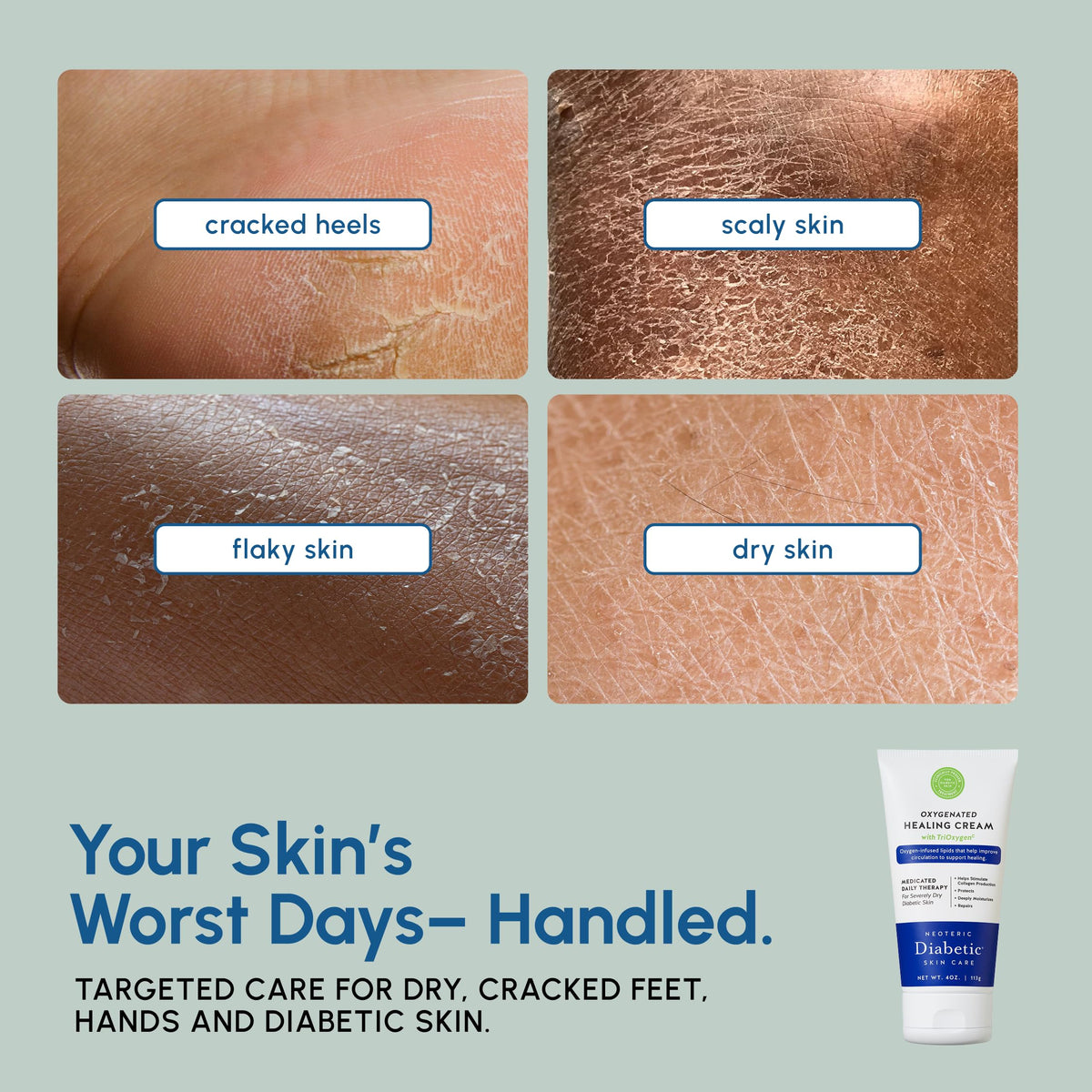 Neoteric pump dispensing cream onto fingertip for quick non-greasy application