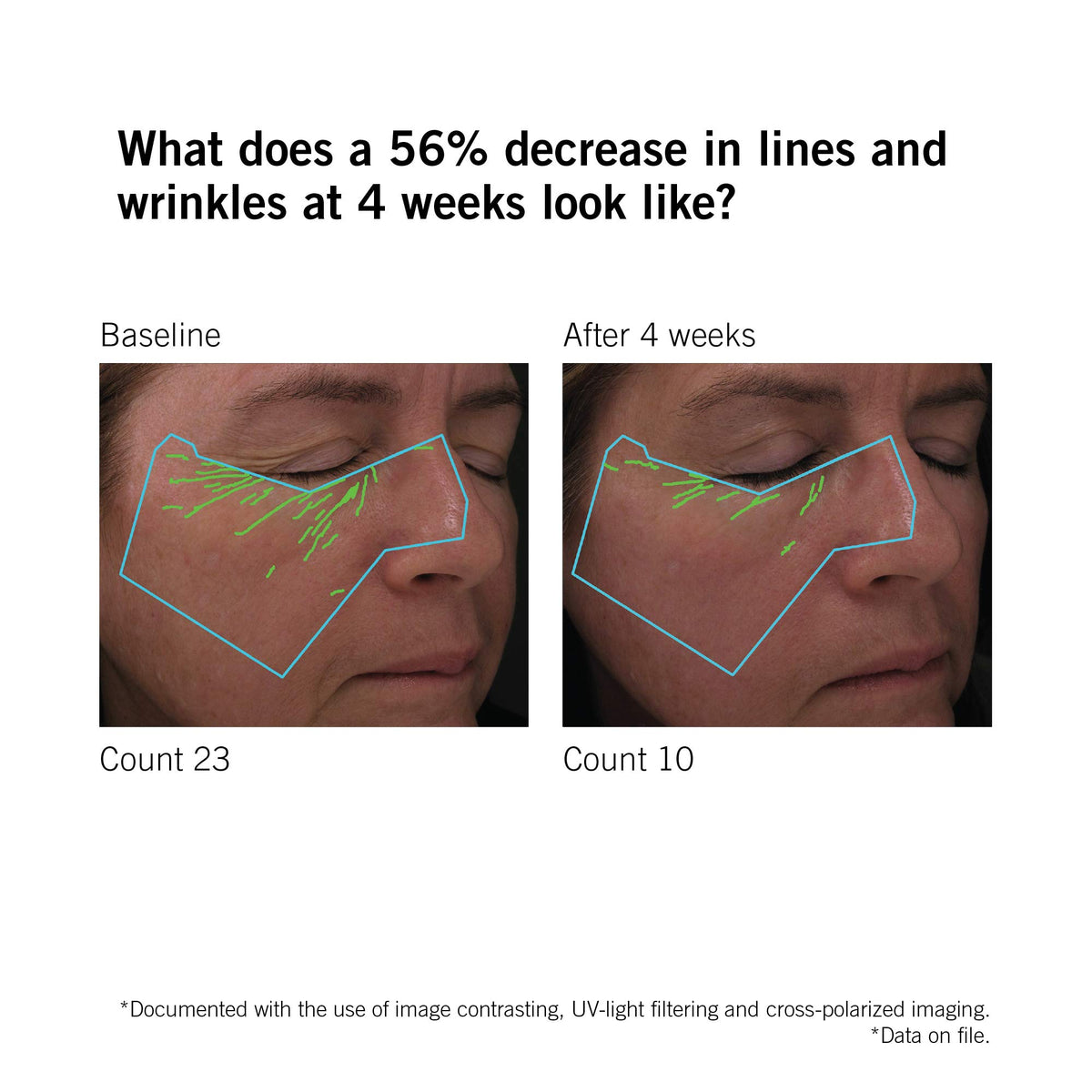 NEOVA serum in bathroom setting suggesting daily routine and visible-results benefit