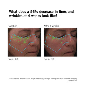 NEOVA serum in bathroom setting suggesting daily routine and visible-results benefit