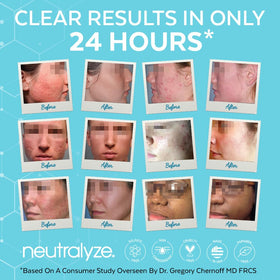 Neutralyze Synergyzer bottle detail highlighting nitrogen boost benefit