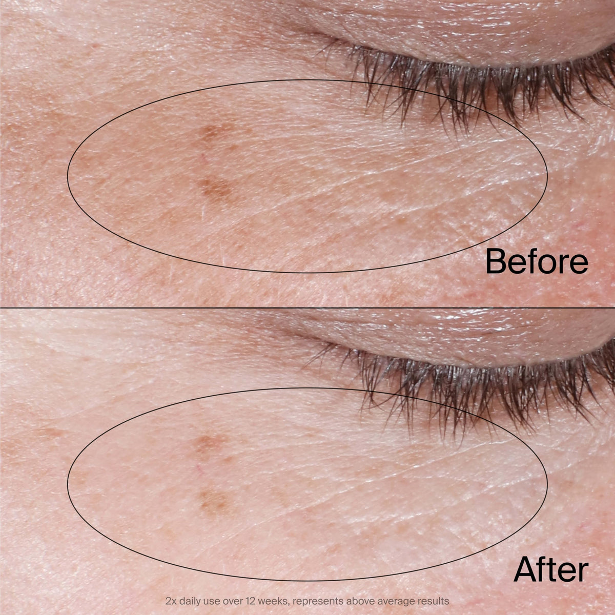 Before and after comparison illustrating Neutrogena's brighter under-eye appearance