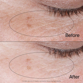 Before and after comparison illustrating Neutrogena's brighter under-eye appearance