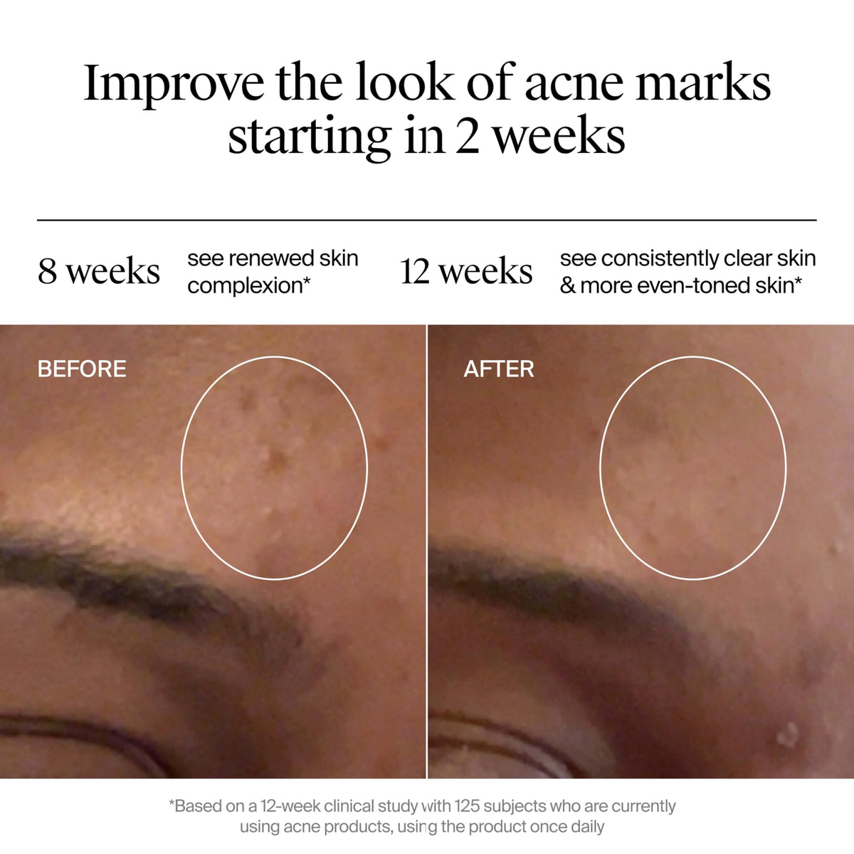 Neutrogena before and after illustration showing improved skin tone benefit