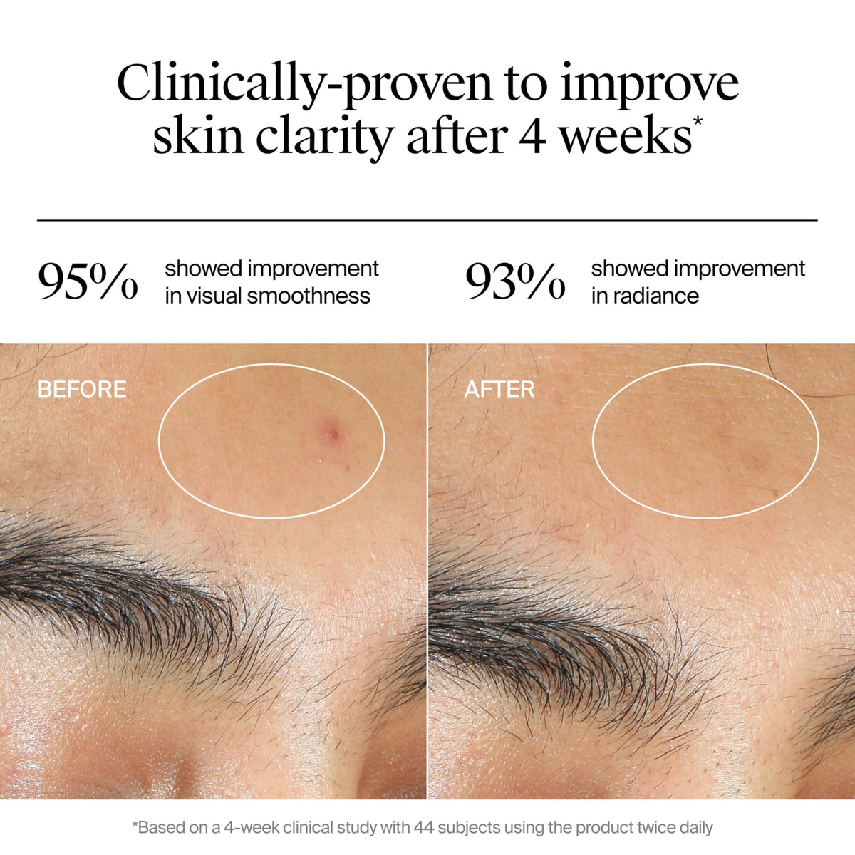 neutrogena before and after skin texture showing visible smoothing benefit