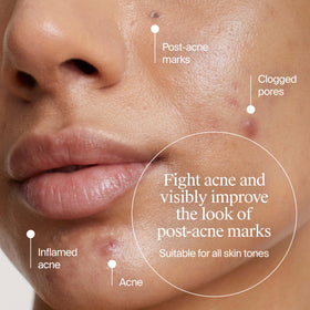 Neutrogena gel texture on fingertip showing lightweight, fast-absorbing benefit