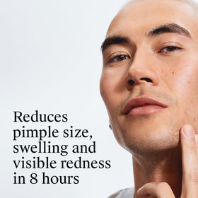 neutrogena pad in hand applying to skin for fast treatment