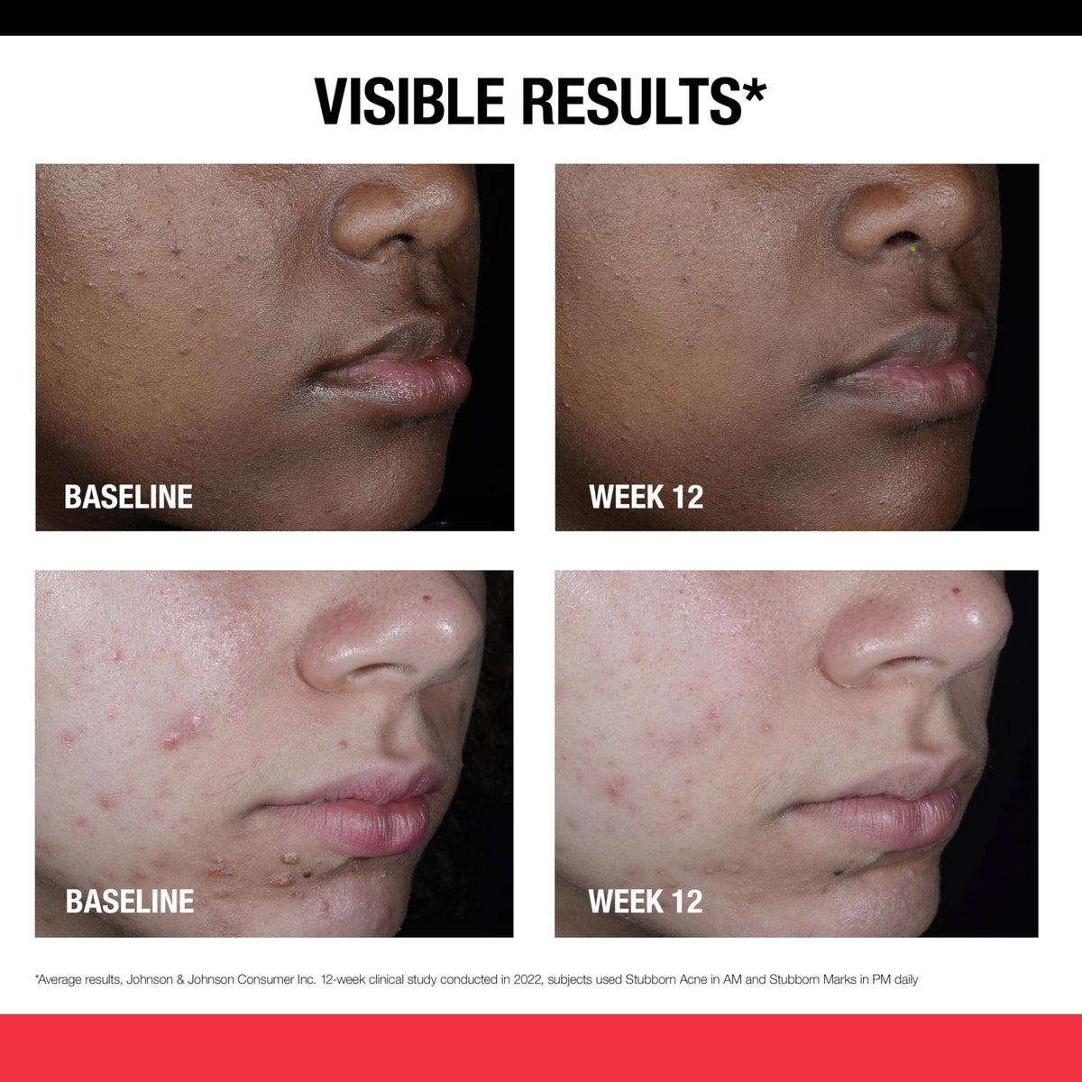 Neutrogena retinol SA label view highlighting key ingredients and benefits