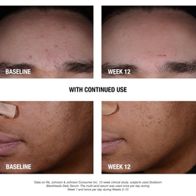 Neutrogena serum texture on skin showing lightweight absorption benefit