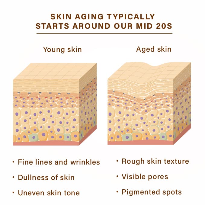 NEW ANGANCE mask applied on model demonstrating even coverage and soothing benefit