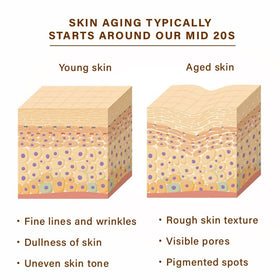 NEW ANGANCE mask applied on model demonstrating even coverage and soothing benefit
