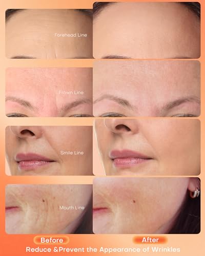 NEWKEY mask worn by model demonstrating comfortable fit and skin-improvement benefit