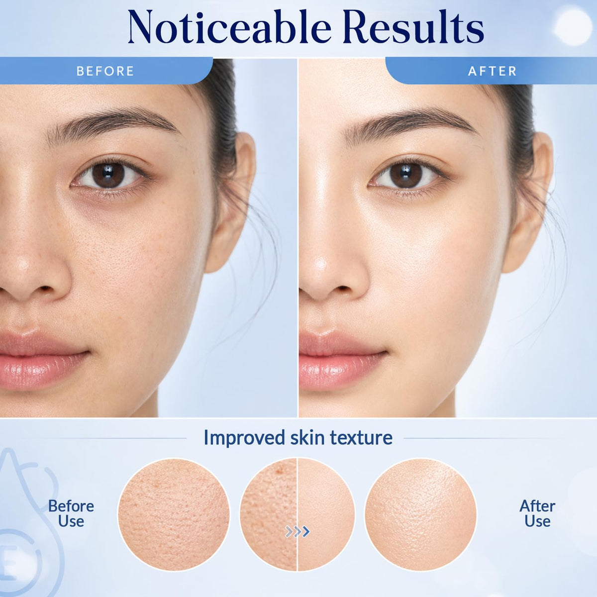 Nexon Botanics gentle under-eye application demonstrating hydrating, smoothing benefit