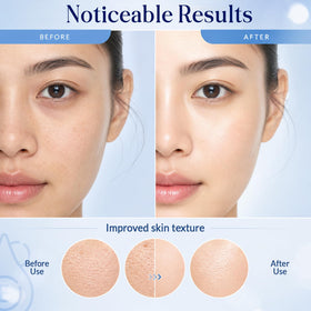 Nexon Botanics gentle under-eye application demonstrating hydrating, smoothing benefit