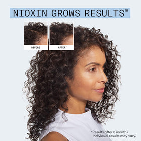 Nioxin bottles in hand for scale showing 8.1 fl oz and 2.3 fl oz sizes
