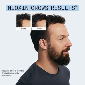 Nioxin kit staged in bathroom showing routine-friendly daily use