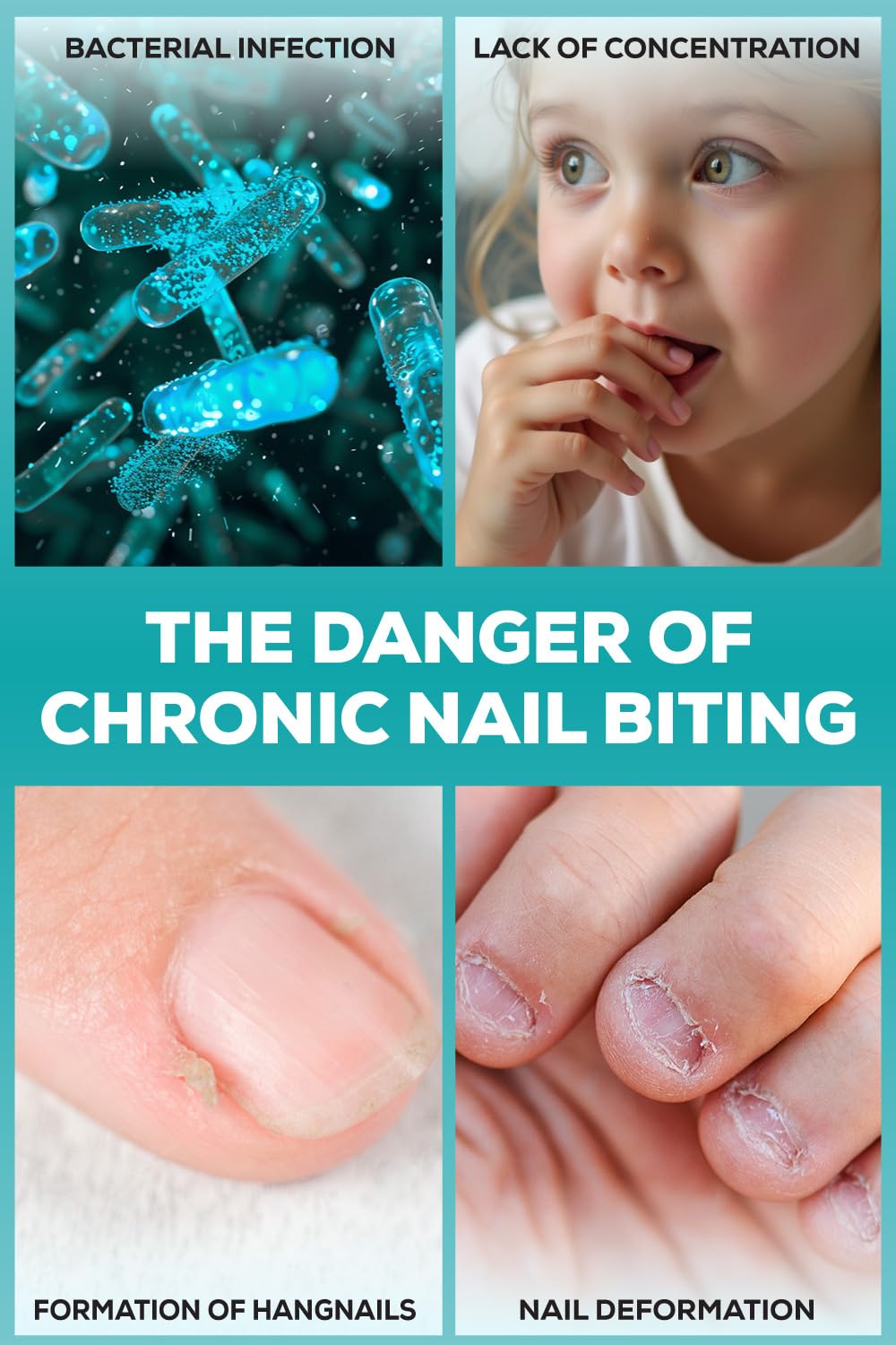 NIXXIT clear low-shine finish on nails showing discreet protection