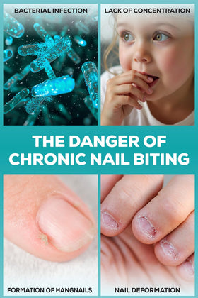 NIXXIT clear low-shine finish on nails showing discreet protection