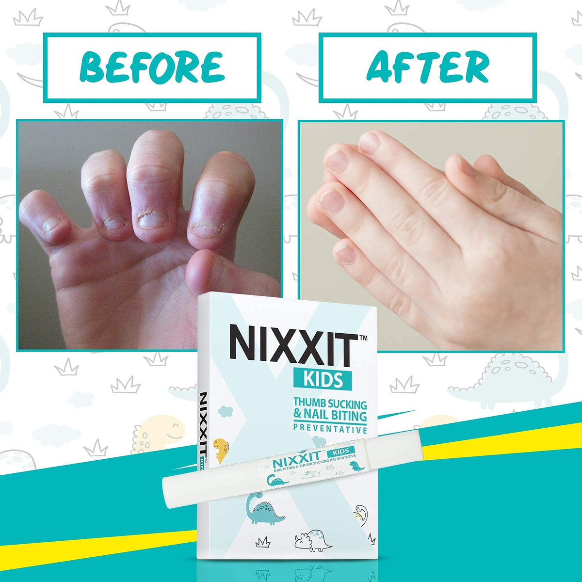 NIXXIT matte finish on nails detail showing non-glossy natural look benefit