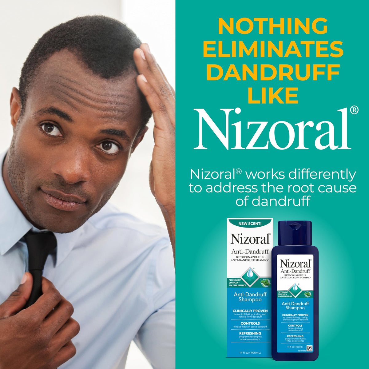 Nizoral bottle next to a hand showing 14 fl oz scale for real-size reference