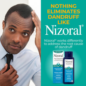 Nizoral bottle next to a hand showing 14 fl oz scale for real-size reference