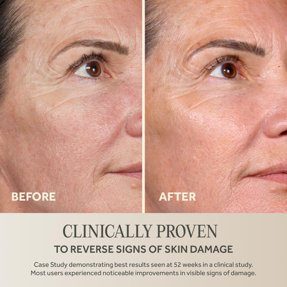 Applying No7 serum to face demonstrating easy daily use